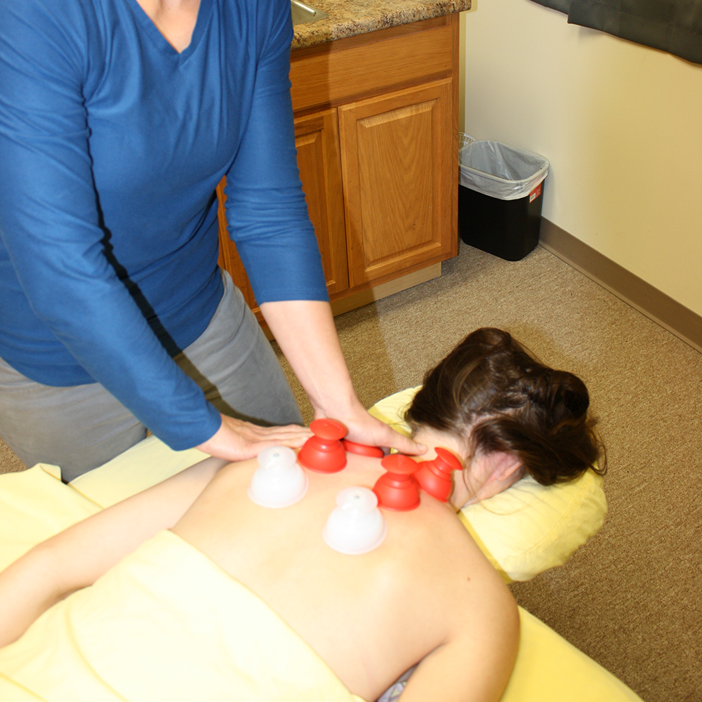 Cupping - MedCare Therapy Center